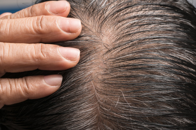 รากผมสีขาว 