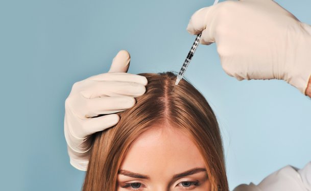 กรรมพันธ์ผมร่วง