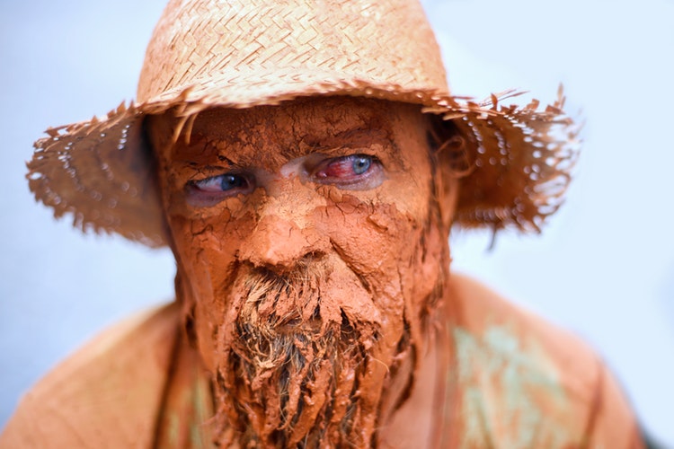 หัวล้าน7แบบ