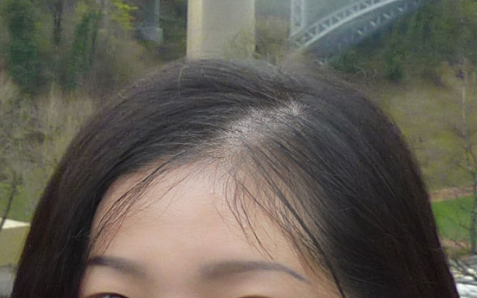 ผู้หญิงผมบาง