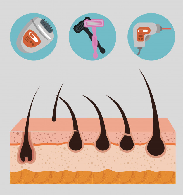 กำจัดไรผมบนหน้าผาก